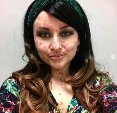 Kissing a stranger, strange spots appear on this woman’s face