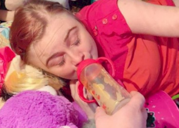 This 22-year-old Girl’s Story Lives Her Life Like a Baby for Years