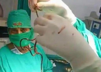 Depression Due To Married Wife Running, This Man Inserts 2 Charger Cables Of 45 Centimeters Length To His Penis
