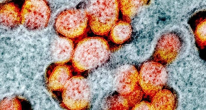 Malaysia Finds Corona Virus Mutations That Are More Contagious 10 Times