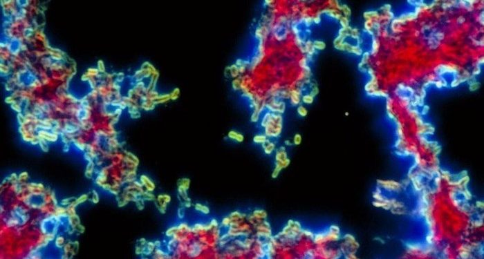 Horrified! There is a New Disease Outbreak in China, These Are the Symptoms and Ways of Transmission