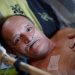 Controversy! Suffering Gravely Illness, This French Man Wants to Broadcast the Moment of His Death