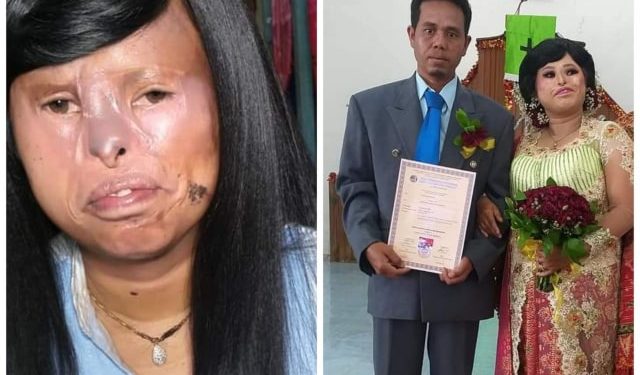 The Evidence of Love that Doesn’t Always Look on Physic, This Batak Woman’s Marriage is Viral