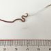 Disgusting! After Eating Sashimi, a Worm was Lodged in This Woman’s Throat