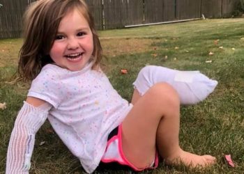 A Little Girl Loses Her Leg After Reversed Over by Mower in Her Home