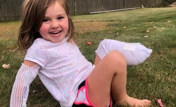 A Little Girl Loses Her Leg After Reversed Over by Mower in Her Home