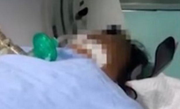 Tragic, Seven Adults Died After Eating a Popular Chinese Noodles that has Become Contaminated With Bongkrek Acid