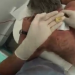 Horror: The Skin Expert Squeezes a Fatty Lump the Size of a Ball From Man’s Back in the UK