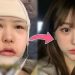 A Popular Korean YouTuber Sharing Her Liposuction Transformation