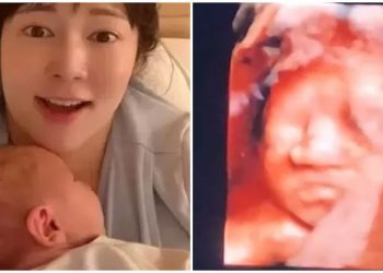 As A Single Woman, Fujita Sayuri Gave Birth Through A Sperm Donor