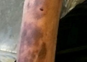 Tragic, a Grandad Slashed With Saw in Bed by Two Masked in Horror Attack