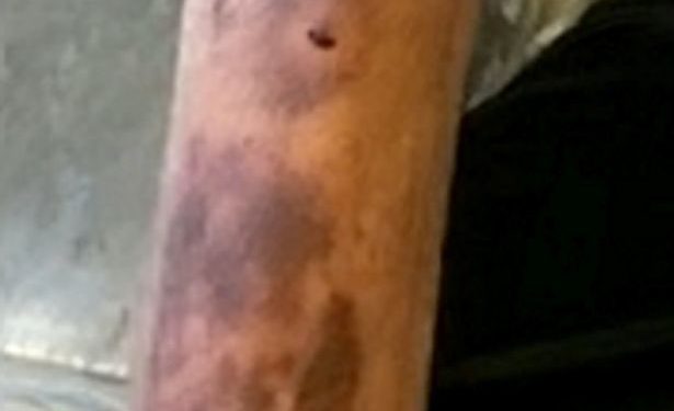 Tragic, a Grandad Slashed With Saw in Bed by Two Masked in Horror Attack