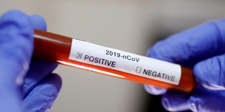 So Sad, 5 Schools In South Solok Should to Closed After 13 Teachers Positive For COVID-19