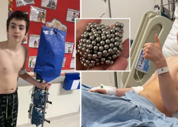 Tragic, a Boy Almost Died After Swallowed 54 Magnets