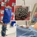 Tragic, a Boy Almost Died After Swallowed 54 Magnets