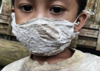 Viral,  Photo Of A Shabby Masked Boy that Living In The Karangasem Shack, Bali