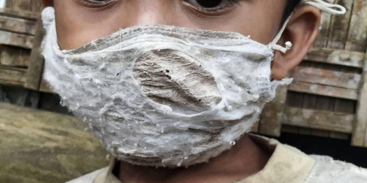 Viral,  Photo Of A Shabby Masked Boy that Living In The Karangasem Shack, Bali