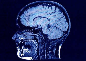 Scientists Have Identified a Serious Impact of Coronavirus on the Brain