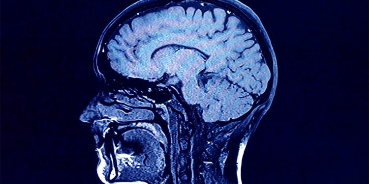 Scientists Have Identified a Serious Impact of Coronavirus on the Brain