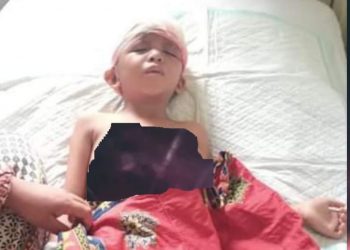 The Regent of Indragiri Hilir Will Responsible for the Medical Expenses of a Girl from Tokolan