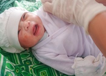 Bayi yang Belum Lahir Ini Berhasil Diselamatkan, Setelah Ibunya Meninggal Akibat Gigitan Kobra