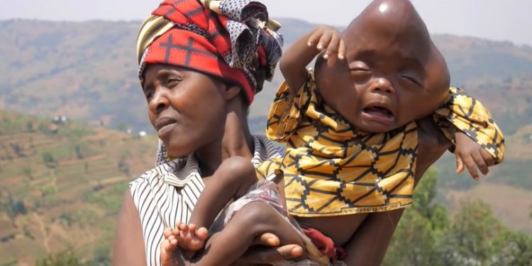 Mengerikan, Pria Keji Ini Menyuruh Istrinya Untuk Membunuh Bayi Mereka yang Cacat, Karena Dijuluki Alien Oleh Penduduk Desa