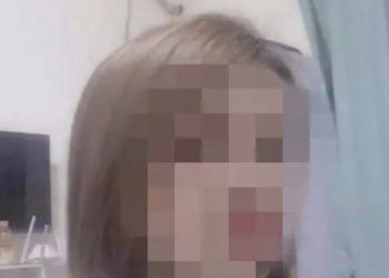 Wanita China Ini Meninggal Setelah Menjalani Prosedur Operasi Pencangkokan Lemak yang Gagal