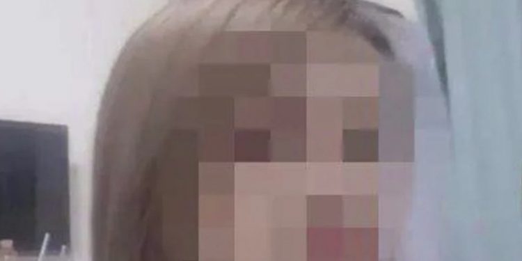 Wanita China Ini Meninggal Setelah Menjalani Prosedur Operasi Pencangkokan Lemak yang Gagal