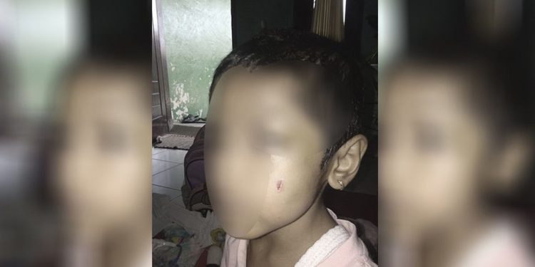 Ibu Tiri di Ciracas yang Aniaya Bocah 5 Tahun Gegara Makanan Bakal Ditindak