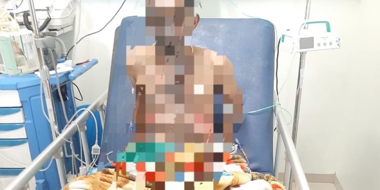 Ditolong Warga, Tukang Cat Pekanbaru Selamat dari Sengatan Listrik