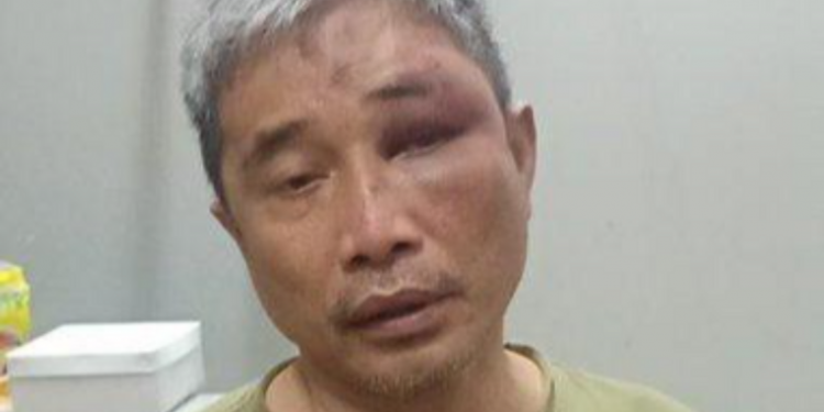 Kepala Rutan Bareskrim Diperiksa Propam Polri Terkait Kasus Penganiayaan Terhadap Muhammad Kece