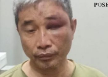 Tak Hanya Dianiaya Hingga Bonyok, Muhammad Kece Ternyata Dilumuri Tinja oleh Irjen Napoleon Bonaparte