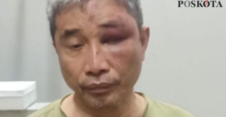 Tak Hanya Dianiaya Hingga Bonyok, Muhammad Kece Ternyata Dilumuri Tinja oleh Irjen Napoleon Bonaparte