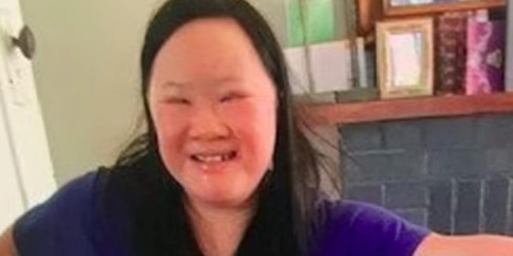 Mayat Wanita yang Idap Down Sindrom Ditemukan di Gang Sempit