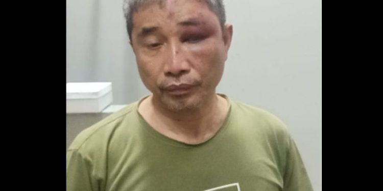 Polisi Segera Gelar Perkara Penetapan Tersangka Penganiayaan Kece