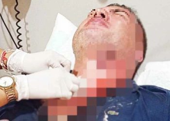 Pria Maroko Ditangkap Setelah Mengiris Leher Warga Selandia Baru Dengan Botol Pecah di Jalanan Bali