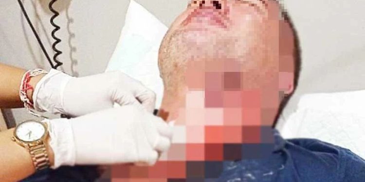 Pria Maroko Ditangkap Setelah Mengiris Leher Warga Selandia Baru Dengan Botol Pecah di Jalanan Bali