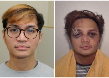Foto Predator Seksual Reynhard Sinaga dengan Wajah Babak Belur Beredar di Media Sosial