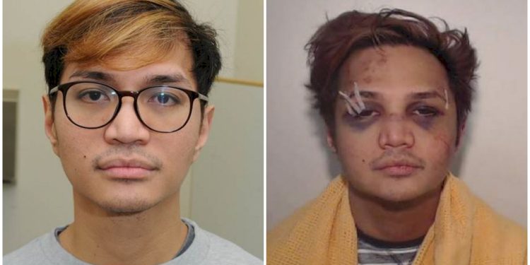 Foto Predator Seksual Reynhard Sinaga dengan Wajah Babak Belur Beredar di Media Sosial