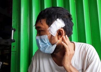 Pria di Bekasi yang Dianiaya Tetangganya Gara-gara WiFi Dihantui Ketakutan