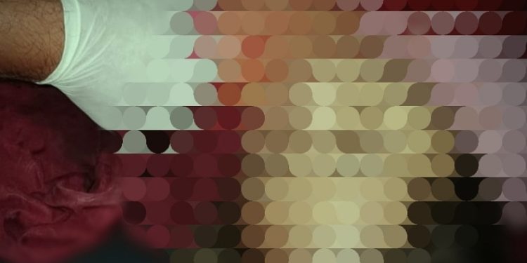 Manado Gempar, Gadis Cantik Dibunuh Sadis Pasangan Sejenis