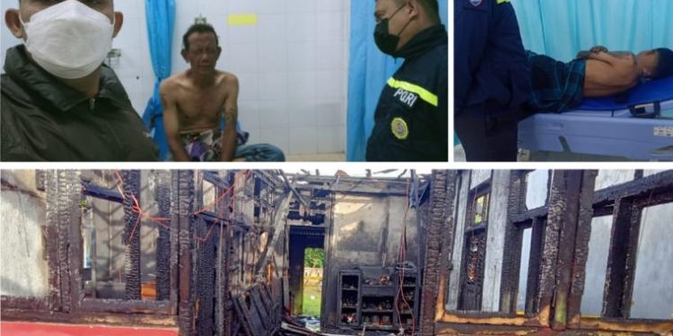 Dua Orang Alami Luka Bakar dan Dua Motor Hangus di Kota Payakumbuh