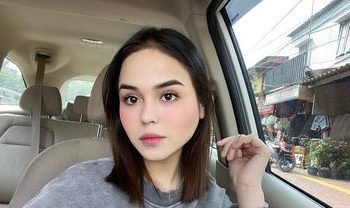 Selebgram Edelenyi Laura Alias Laura Anna Meninggal Dunia