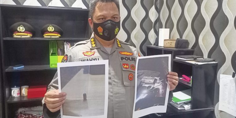 Diduga Tertembak Pistol Oknum Polisi, Gadis Cilik Asal Gorontalo Cedera di Paha Kanan