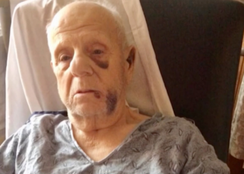 Pria 82 Ini Diserang Sekelompok Pengendara Motor Trail Hingga Babak Belur