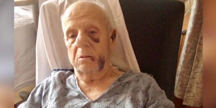 Pria 82 Ini Diserang Sekelompok Pengendara Motor Trail Hingga Babak Belur