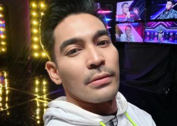 Kecelakaan, Robby Purba Dilarikan ke IGD Akibat Darah Tak Berhenti Mengalir