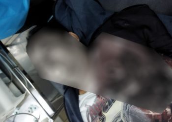 Dada Kiri Sobek, Pengemudi Ojol di Kemayoran Ditemukan Tewas