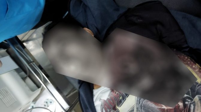 Dada Kiri Sobek, Pengemudi Ojol di Kemayoran Ditemukan Tewas