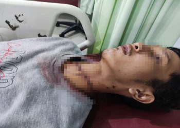 Cekcok Dengan Mertua, Menantu di Pekanbaru Nekat Gorok Leher Pakai Pisau Cutter
